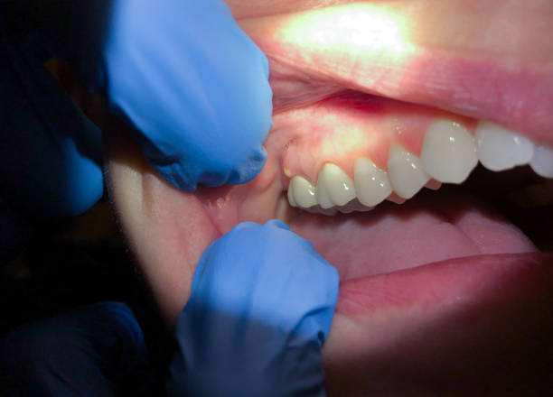 Best Emergency Dental Services for Seniors in Fayetteville, NC